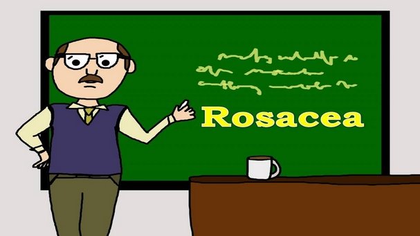 Rosacea Disease