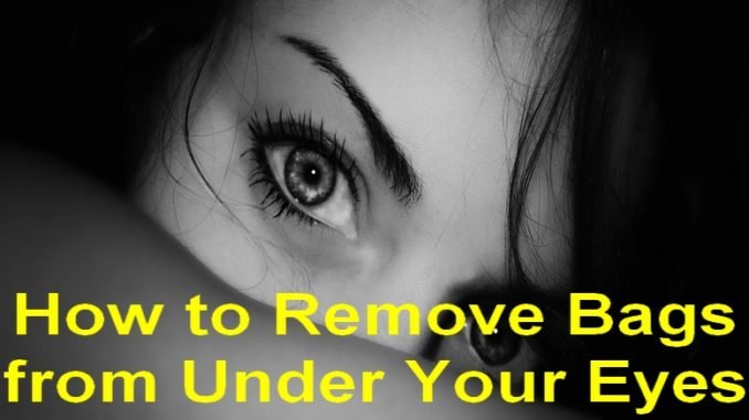 How to Get Rid of Eye Bags Permanently How to Get Rid of Eye Bags Permanently