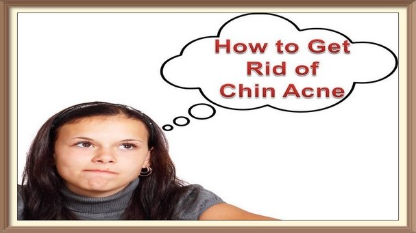 How to Get Rid of Chin and Neck Acne